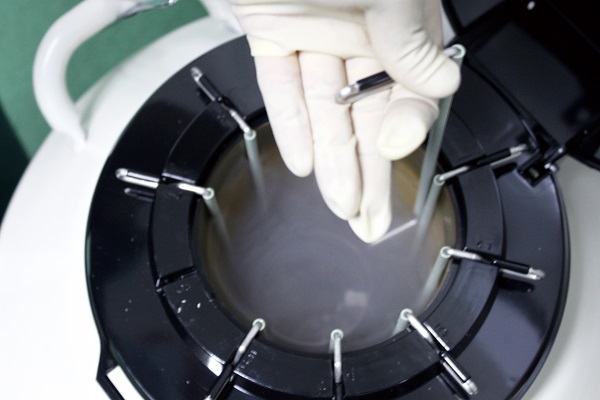 试管婴儿,试管冻胚移植,昆明试管移植冷冻胚胎